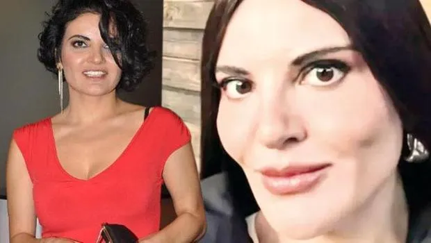 Göksel'den Estetik İddialarına Cevap: O Kişiyi Tanımıyorum!