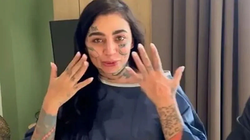 İstanbul'da estetik ameliyat olan ünlü fenomen hayatını kaybetti